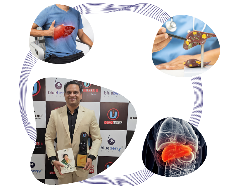 Liver Transplant Specialist