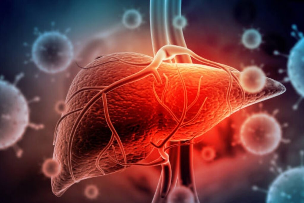 Acute Liver Treatment