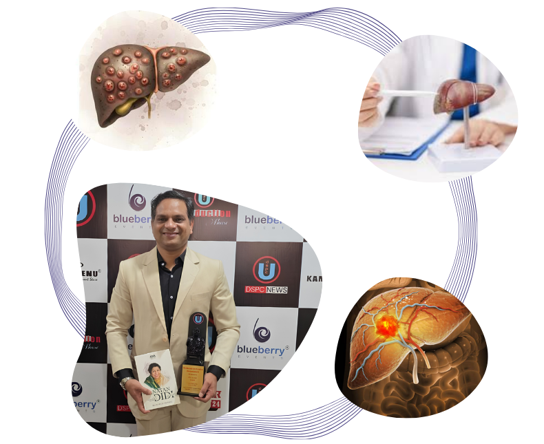 Liver Cancer Surgery