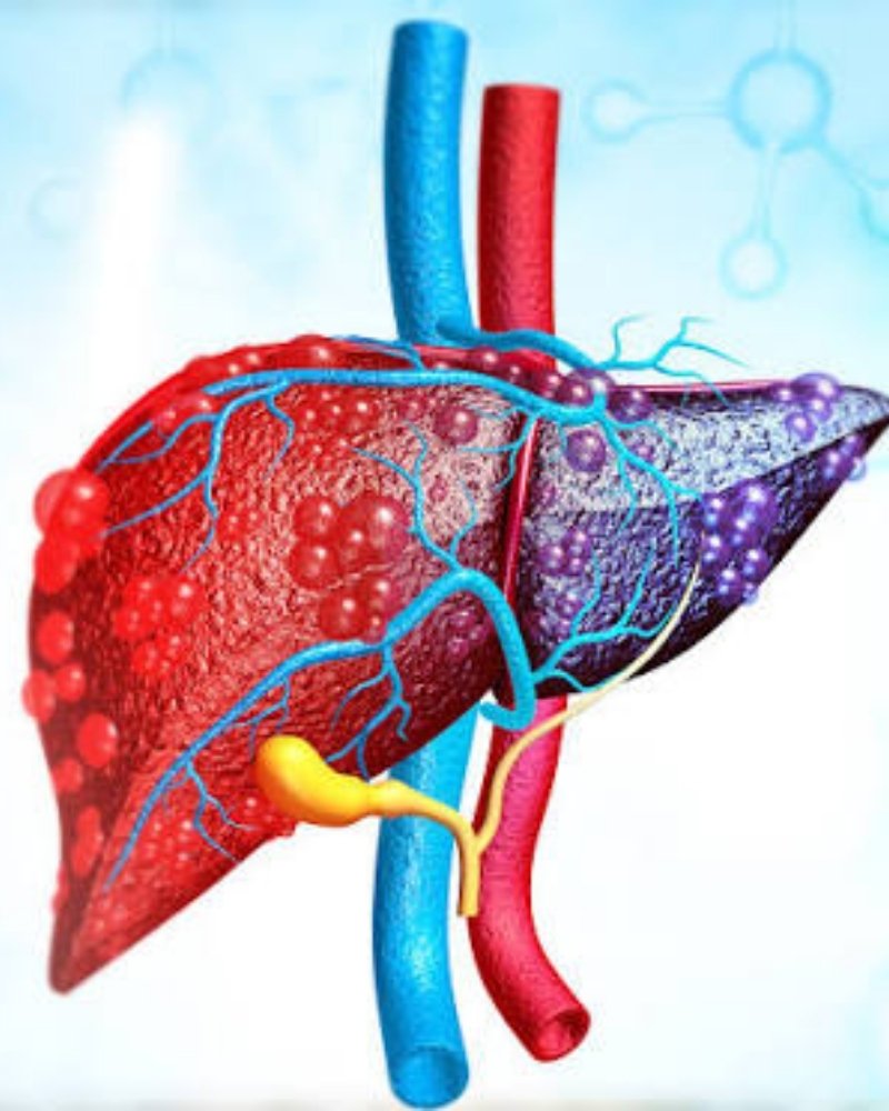 Portal Hypertension in Mumbai