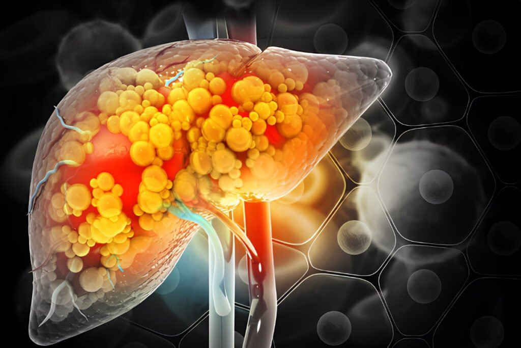 Fatty Liver Disease Treatment in Mumbai