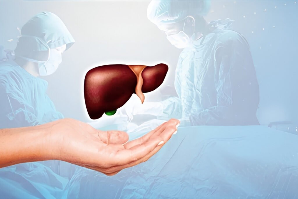Liver Transplant