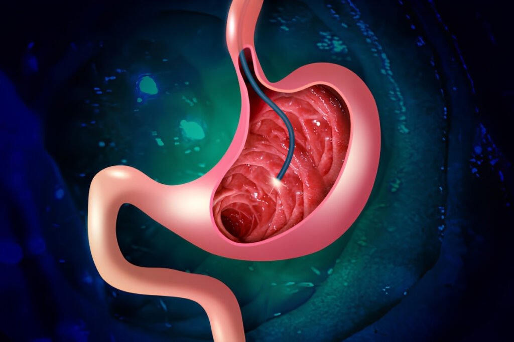 Upper GI Endoscopy Specialist