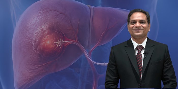Expertise in Liver Cancer Management