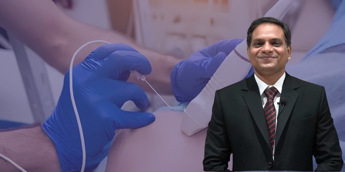 Expertise in Radio Frequency Ablation