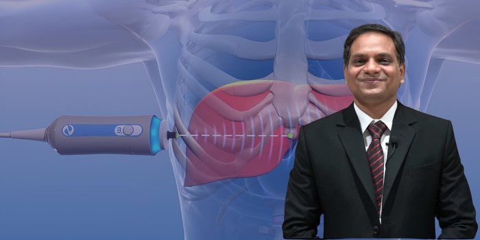 Expertise in FibroScan