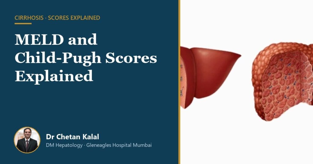 MELD and Child-Pugh score explained — Dr Chetan Kalal, hepatologist, Gleneagles Hospital Mumbai