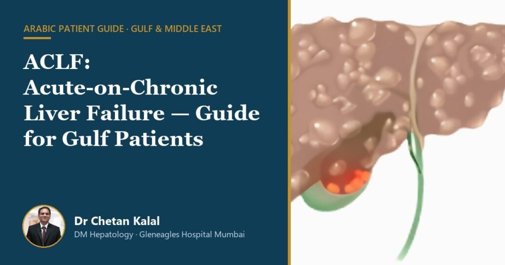 ACLF acute-on-chronic liver failure Arabic guide for Gulf patients by Dr Chetan Kalal
