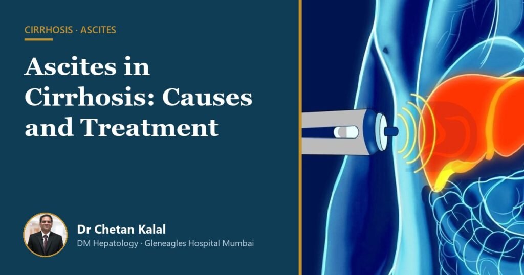Ascites in cirrhosis — Dr Chetan Kalal, hepatologist, Gleneagles Hospital Mumbai
