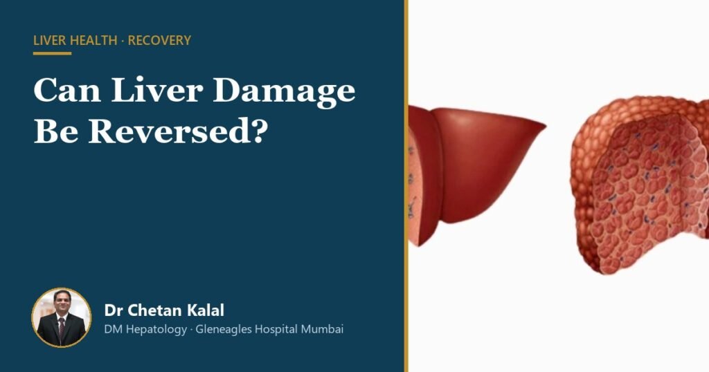 Healthy liver versus cirrhotic liver — can liver damage be reversed, Dr Chetan Kalal