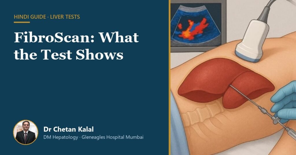 FibroScan: What the Test Shows — Dr Chetan Kalal, hepatologist, Gleneagles Hospital Mumbai