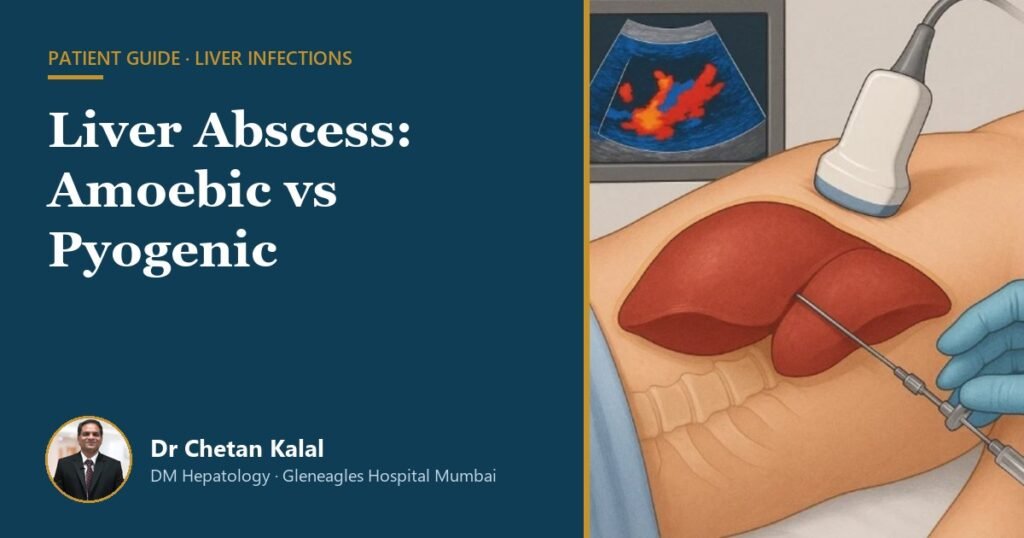 Liver abscess amoebic vs pyogenic, guide by Dr Chetan Kalal, hepatologist Mumbai