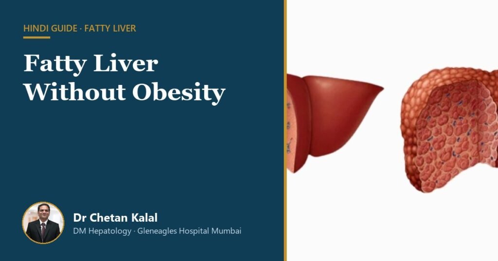 Fatty Liver Without Obesity — Dr Chetan Kalal, hepatologist, Gleneagles Hospital Mumbai