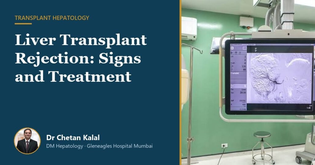 Liver transplant rejection signs and treatment, Dr Chetan Kalal