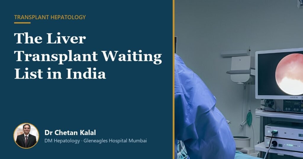 Liver transplant waiting list in India explained by Dr Chetan Kalal