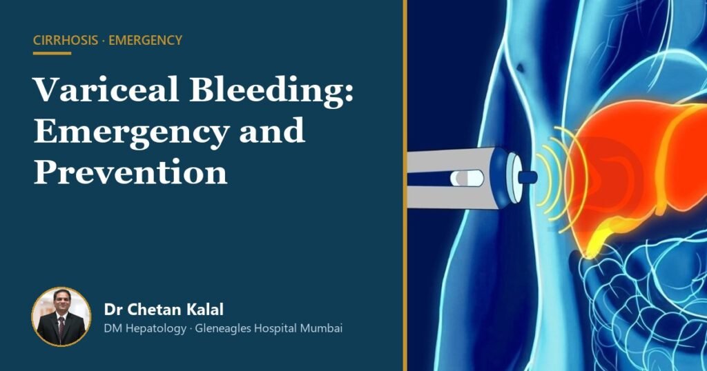 Variceal bleeding in cirrhosis — Dr Chetan Kalal, hepatologist, Gleneagles Hospital Mumbai