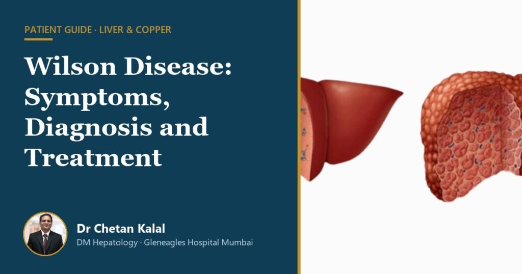 Wilson disease patient guide by Dr Chetan Kalal, hepatologist, Gleneagles Hospital Mumbai